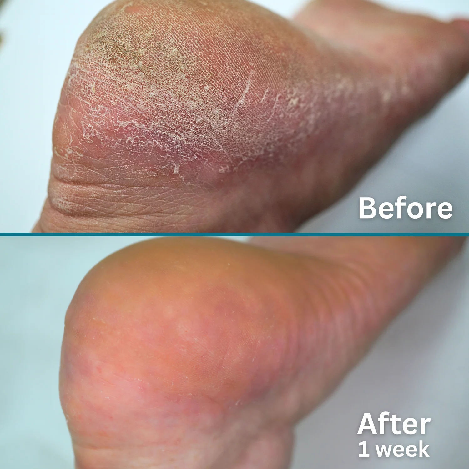DD_Cream_Mousse_Before_After_1.png